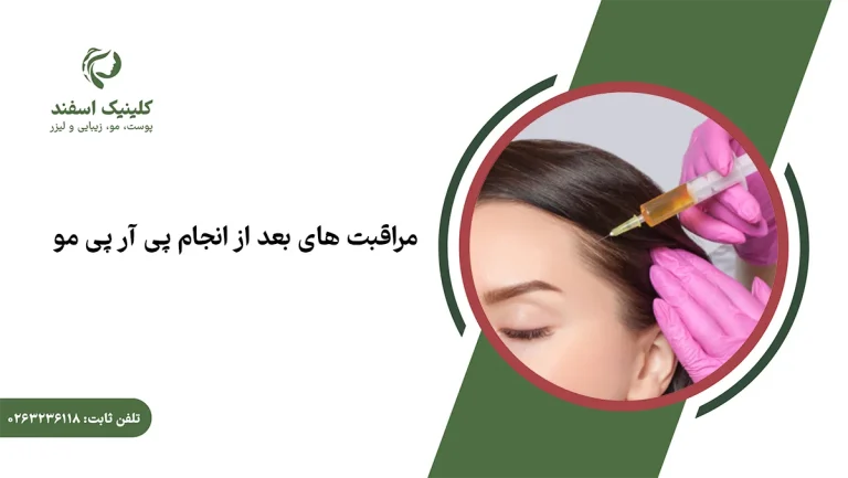 مراقبت های بعد از پی آر پی مو