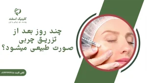 چند روز بعد از تزریق چربی صورت طبیعی میشود؟