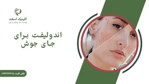 اندولیفت برای جای جوش