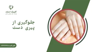 جلوگیری از پیری دست