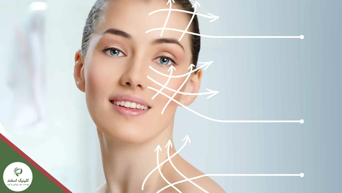 مزیت هایفو نسبت به اندولیفت