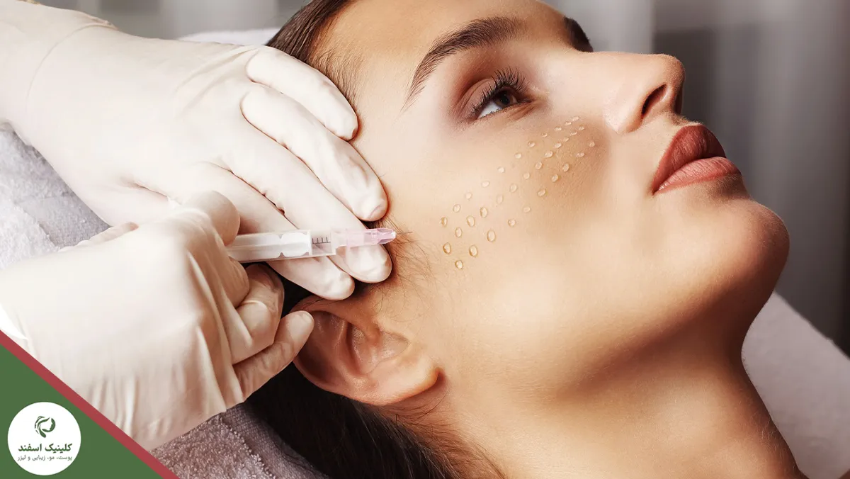 نحوه عملکرد و انجام هایفو