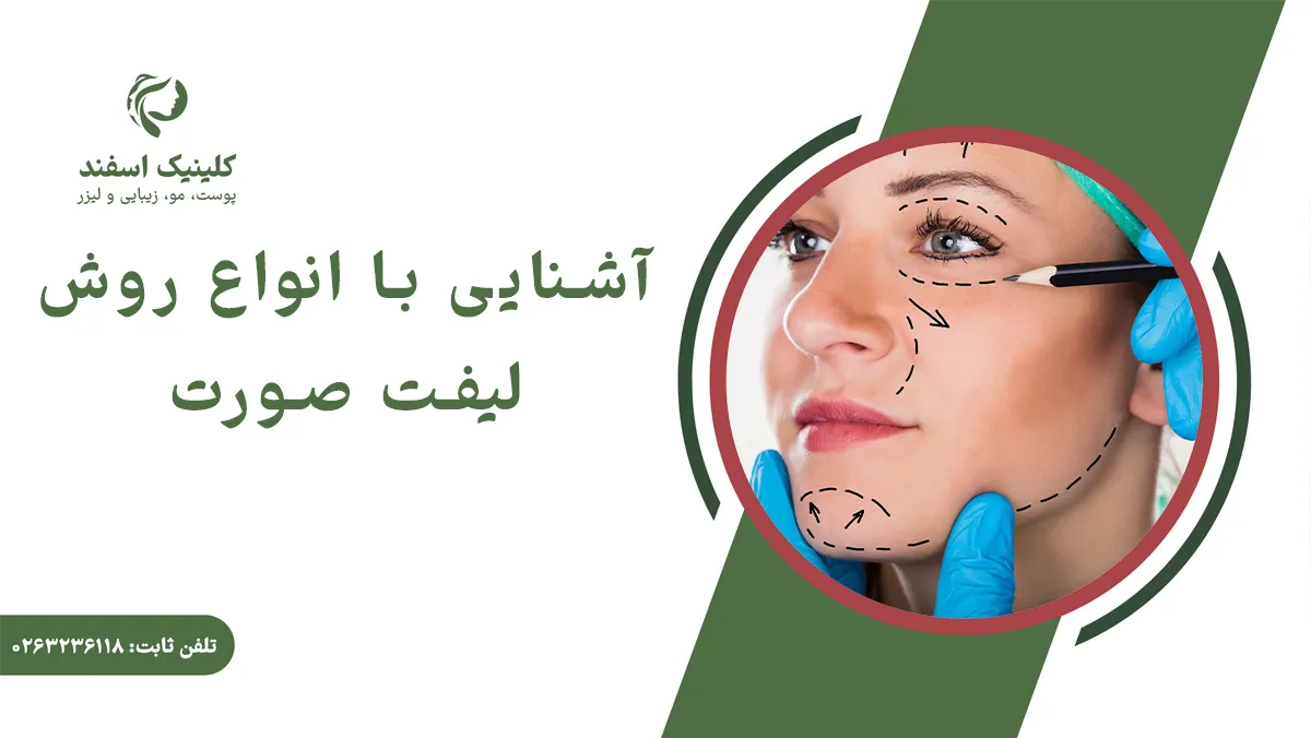 آشنایی با انواع روش لیفت صورت
