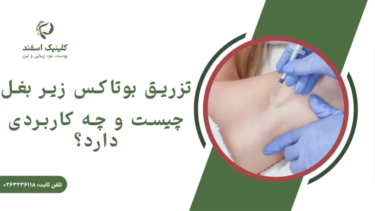 تزریق بوتاکس زیر بغل چیست و چه کاربردی دارد؟